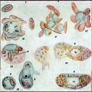 Иллюстрация к статье Мечникова о фагоцитозе «Ре­зорбция клеток»